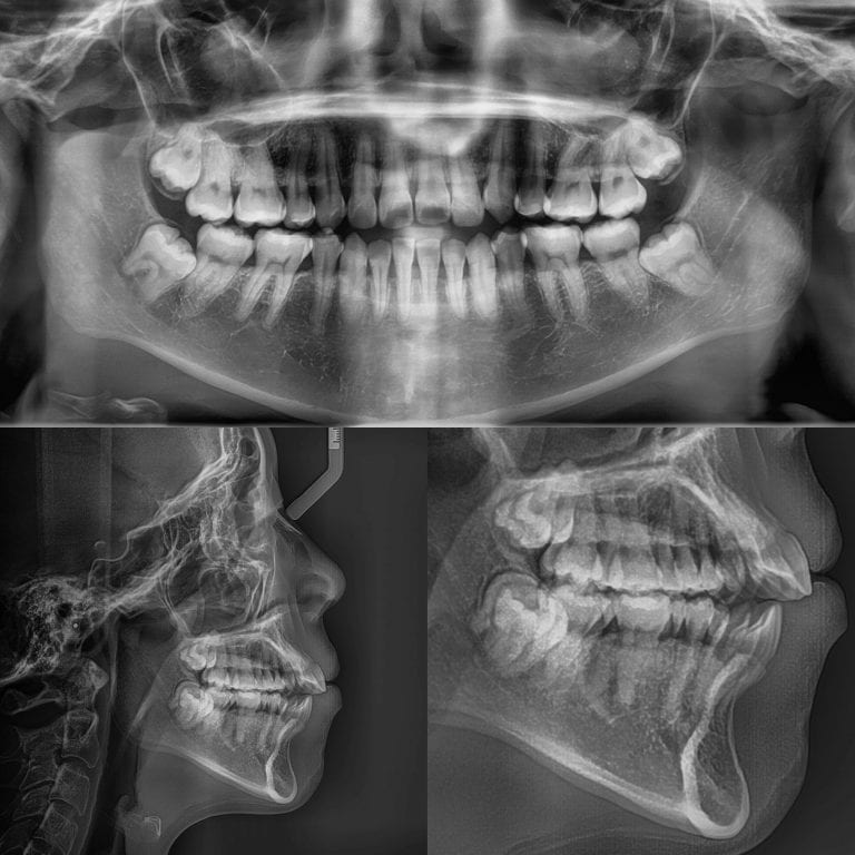 Dr. P'Jay Merrell - Best Lubbock Dentist Dentist in Lubbock, TX Cosmetic Dentist Lubbock Restorative Dentist Lubbock Cosmetic Dentistry Lubbock Restorative Dentistry Lubbock General Dentistry Lubbock Laser Dentistry Lubbock Preventative Dentistry Lubbock Dental Implants Lubbock Prosthodontist Lubbock