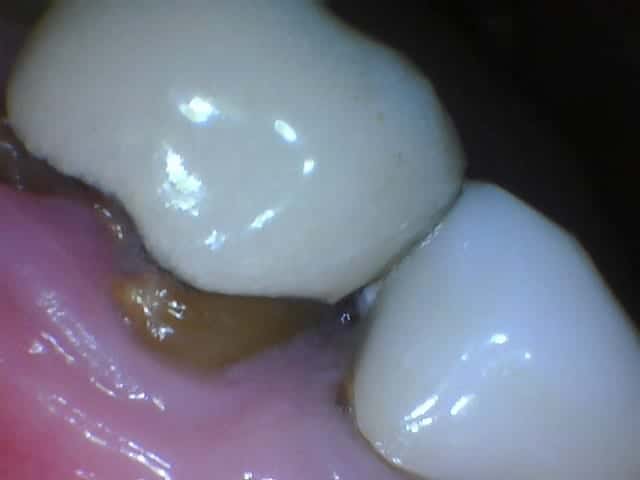 Dr. P'Jay Merrell - Best Lubbock Dentist Dentist in Lubbock, TX Cosmetic Dentist Lubbock Restorative Dentist Lubbock Cosmetic Dentistry Lubbock Restorative Dentistry Lubbock General Dentistry Lubbock Laser Dentistry Lubbock Preventative Dentistry Lubbock Dental Implants Lubbock Prosthodontist Lubbock