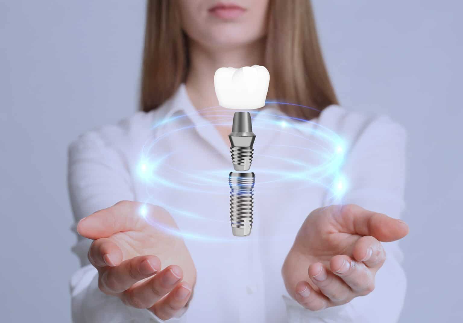 Dental Crowns Lubbock